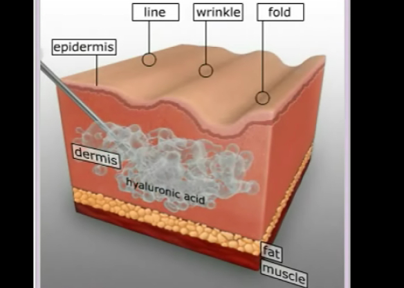 Hyaluronic Acid