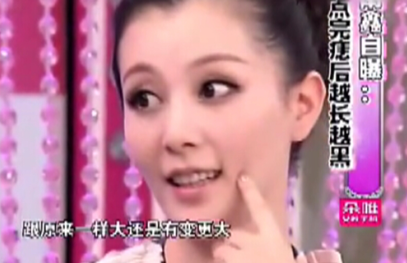 乱点痣会丧命