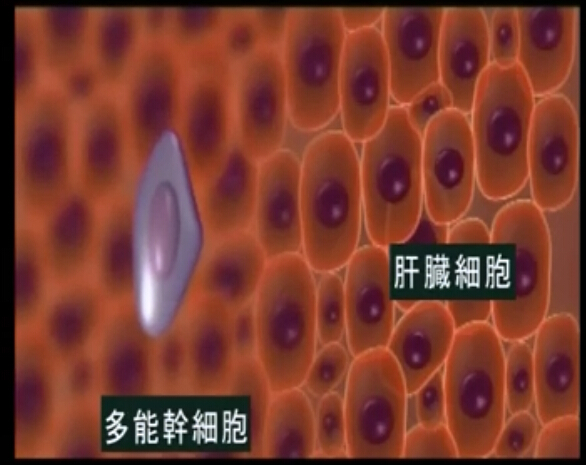 干细胞移植