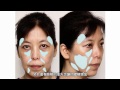 3D聚左旋乳酸、舒颜萃台湾发表会